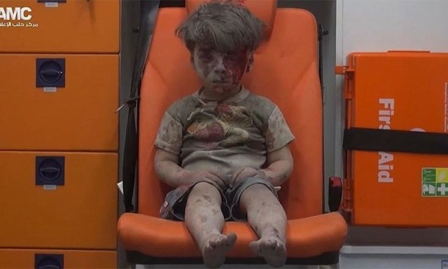 Imran Daqneesh دنیا کو تڑپانے والا عمران دقنیش نامی بچہ