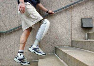 Bionic Body Parts